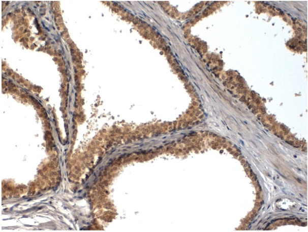 Immunohistochemical staining of FFPE human prostate tissue using Neurogenin-1 antibody (Cat. No. X2758P).  Antibody used at 1 µg/ml and visualized using DAB.  Pathologist Comments: Cytoplasmic and nuclear staining on glandular epithilium.